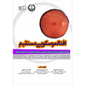 افتالموسکوپی مستقیم